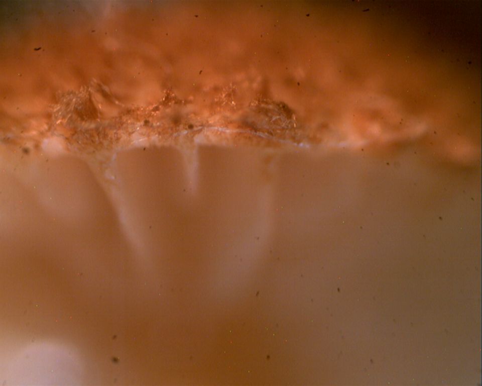 Phaeomarasmius erinaceus